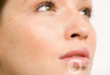 祛斑手術(shù)價格貴不貴？要多少錢？