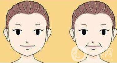 冰電波拉皮除皺*果如何？有哪些優(yōu)點(diǎn)？