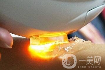 彩光嫩膚的價(jià)格一般是多少？