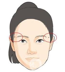 點(diǎn)痣后注意事項(xiàng)一定要遵守，否則會留疤！