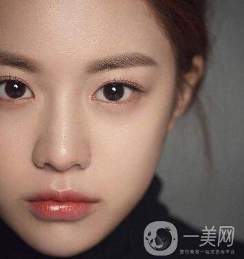 如何讓鼻梁變高？可以注射玻尿酸嗎？