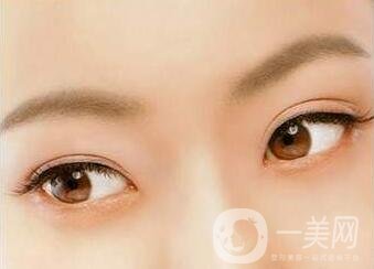 三點定位雙眼皮手術(shù)后應(yīng)該注意些什么？