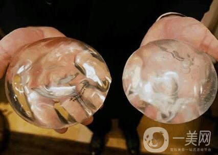 胸部整形術(shù)要多少錢(qián)?大概價(jià)位說(shuō)明