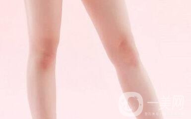 大腿部吸脂塑形術(shù)后護理的那些事兒