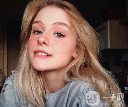 紅寶石激光祛斑多少錢？術(shù)后怎么護理？