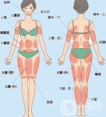 全身抽脂價格是多少？