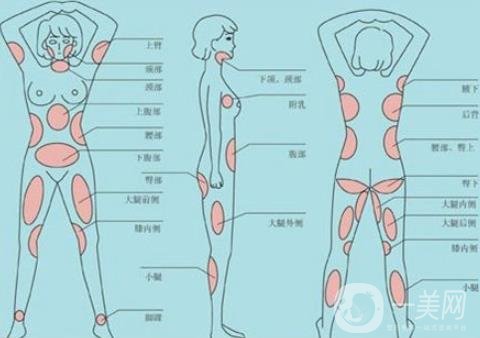 全身抽脂減肥多少錢？貴嗎？