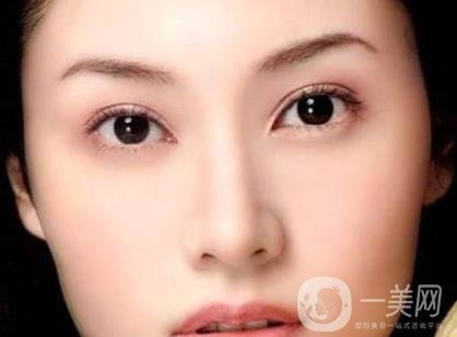 吸雕雙眼皮手術是什么？是埋線嗎？
