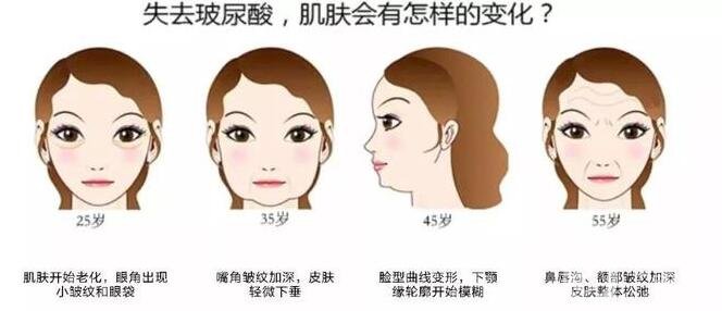 注射瑞藍玻尿酸價格是全國統一的嗎?有哪些區(qū)別