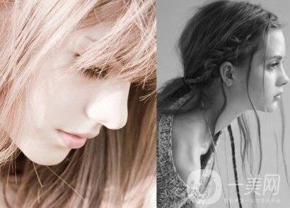 怎樣讓鼻子變高？隆鼻可以讓鼻子變高嗎？