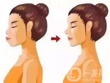 雙頜前突帶牙套可以矯正嗎？