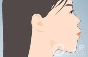 雙頜前突帶牙套可以矯正嗎？