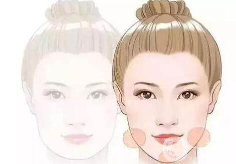 【至小白篇】玻尿酸有幾種品牌和類型?