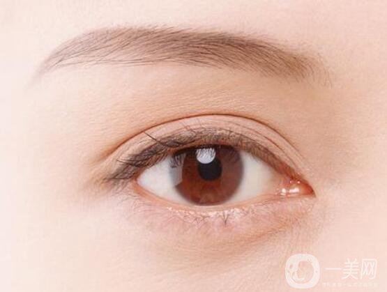 做埋線雙眼皮幾天能消腫?注意事項(xiàng)盤點(diǎn)全在這了!