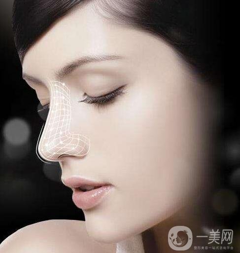 肋骨隆鼻可以一輩子嗎?