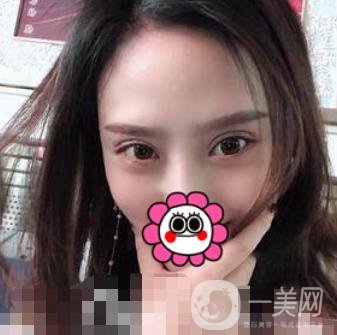 溫嶺芘麗芙整形醫(yī)院2020年價格表更新_雙眼皮整形*果實拍