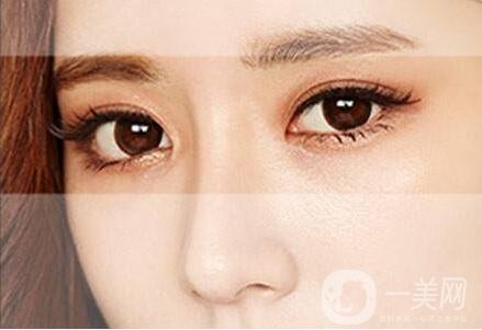 三點(diǎn)雙眼皮和全切信息介紹?