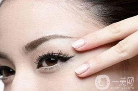 須知_嗨體祛除頸紋的常見的4個問題