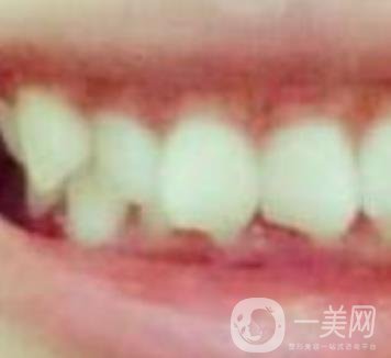 張家港澳洋醫(yī)院整牙