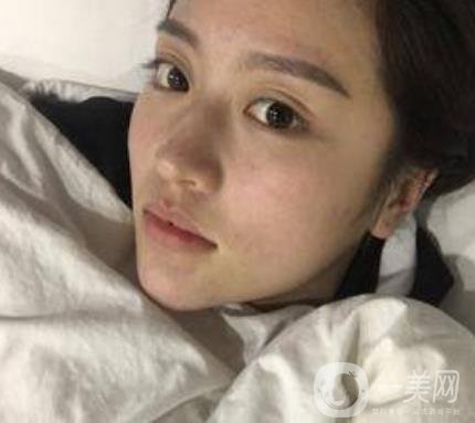 河北省人民醫(yī)院整形外科價(jià)格表新版來襲，附去下頜骨案例