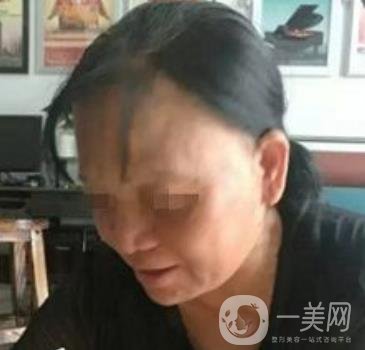 廣東省人民醫(yī)院整形科價(jià)格表，附祛斑整形日記