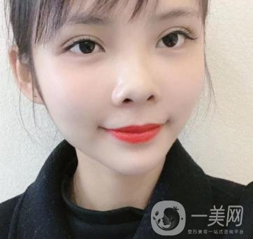 西安交通大學(xué)附屬醫(yī)院整形美容科價格表和雙眼皮案例一覽