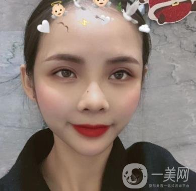 西安交通大學(xué)附屬醫(yī)院整形美容科價格表和雙眼皮案例一覽