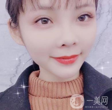 西安交通大學(xué)附屬醫(yī)院整形美容科價格表和雙眼皮案例一覽