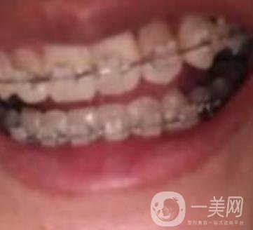 蘭山區(qū)人民醫(yī)院整牙