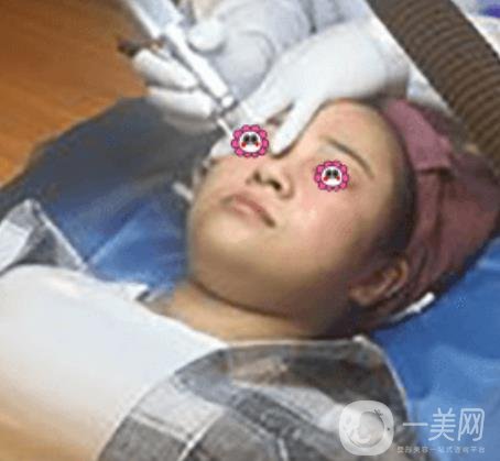 岳陽(yáng)市第一人民醫(yī)院整形美容科祛斑好嗎？?jī)r(jià)格表和案例日記分享