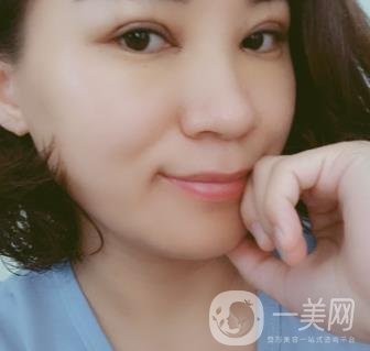 中山一院整形科價格表,及切腋臭日記一覽