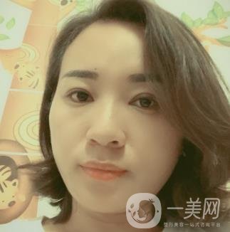 中山一院整形科價格表,及切腋臭日記一覽