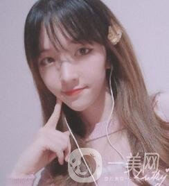 南昌二附院整形科價格表2020，附肋軟骨隆鼻整形案例