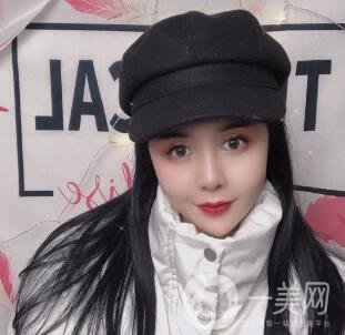 景德鎮(zhèn)第一人民醫(yī)院整形科價格表，附面部吸脂瘦臉案例