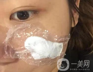 西安市中心醫(yī)院整形科價目價格一覽，附陶諫祛疤案例*果圖