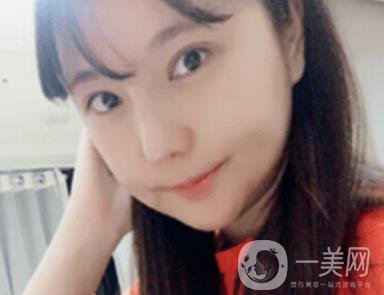 廣州博仕整形醫(yī)院做鼻子多少錢?價(jià)格表和整形恢復(fù)日記一覽