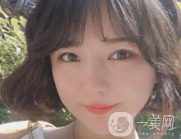 廣州博仕整形醫(yī)院做鼻子多少錢?價(jià)格表和整形恢復(fù)日記一覽