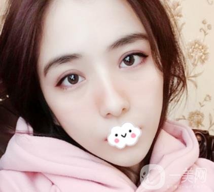 上海伯思立整形怎么樣？附沈國雄隆鼻案例及整形價格表