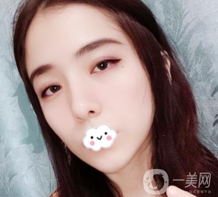 上海伯思立整形怎么樣？附沈國雄隆鼻案例及整形價格表