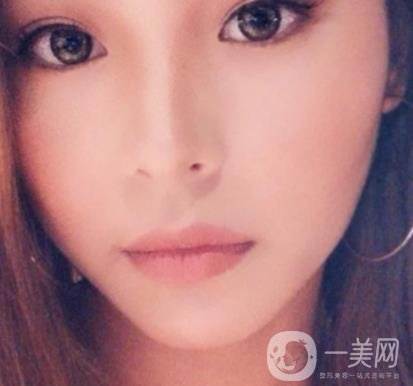 上海九院切下頜角手術經歷分享，附2020整形價格一覽表