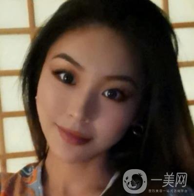 上海九院切下頜角手術經歷分享，附2020整形價格一覽表