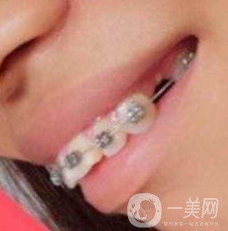 長征醫(yī)院 整牙