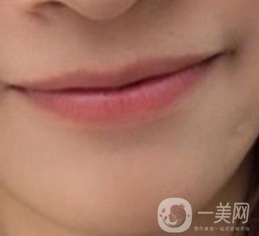 長征醫(yī)院 整牙