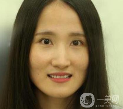 北京市海淀醫(yī)院整牙多少錢？看價(jià)格表及案例*果