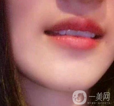 北京市海淀醫(yī)院整牙多少錢？看價(jià)格表及案例*果