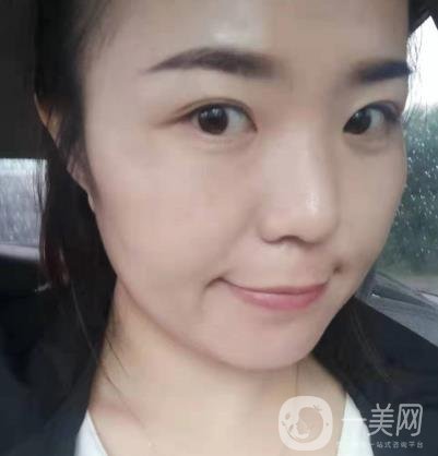 吉大一院整形美容科價格表費用明細，附祛斑案例