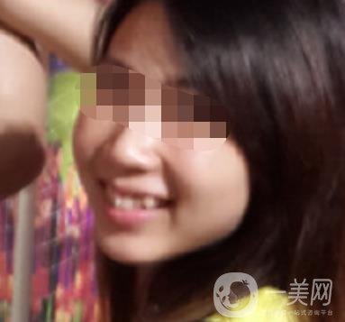 南昌大學(xué)第二附屬醫(yī)院整牙60天案例，還有價(jià)格表哦