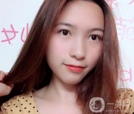 沈陽軍區(qū)總醫(yī)院整形外科價(jià)格表2020，附雙眼皮案例