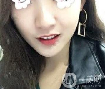 浙二醫(yī)院整形美容科價格表*新版，附激光祛斑*終*果圖