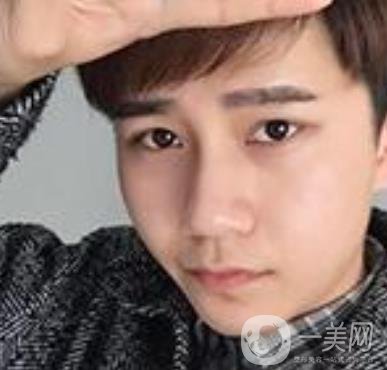 棗莊市立醫(yī)院燒傷整形美容科做光子嫩膚好嗎？價格表及術(shù)后*果分享